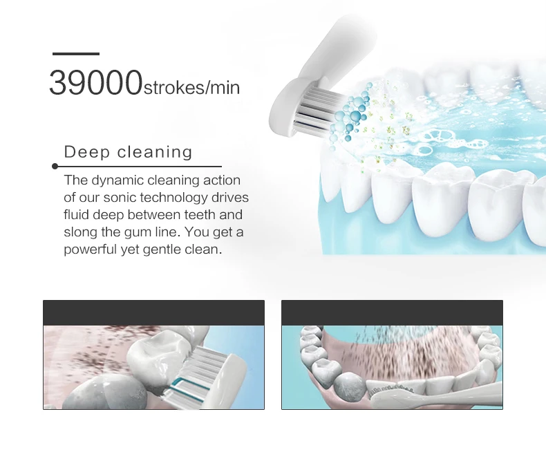 Supersonic Toothbrush Clean As Dentist Rechargeable Sonic Toothbrush