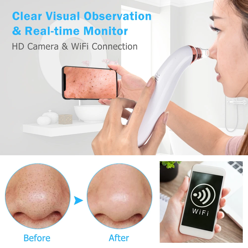 2020 New Wireless Visual Whitehead Bestope Suction Set Nose Device Blackhead Remover Vacuum With Camera Wifi.jpg