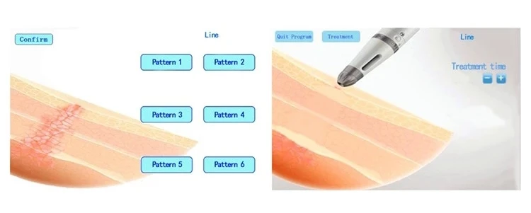 Korea Needle Free Skin Nutrient Water Ultrasonic Serum Dermaheal Mesotherapy Gun Machine