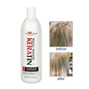 /product-detail/amazon-bio-keratin-gold-brazilian-keratin-therapy-products-hair-straightening-cream-rebonding-keratin-62325415362.html