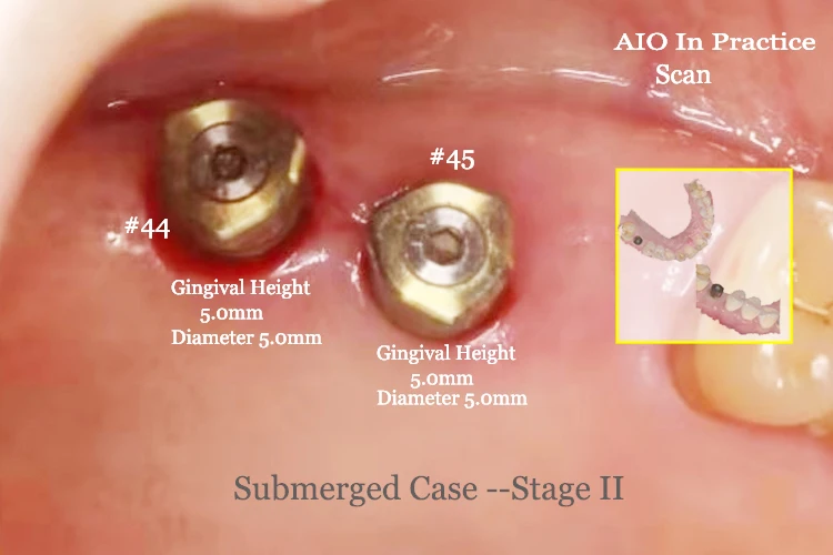 AIO-II.jpg