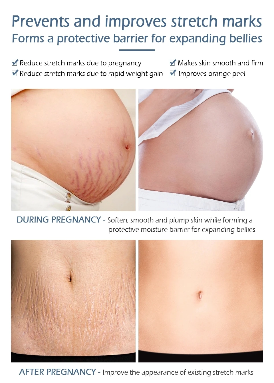 stretch marks removal-14.jpg