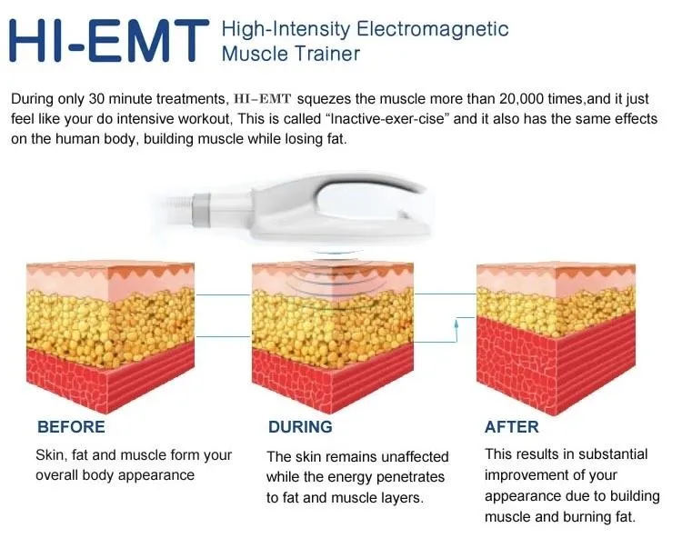 Amazing Technology 2020 TeslaSculpt EMS Muscle Stimulator HIEMT 7 Tesla High Intensity Electromagnetic Body Contouring Slimming