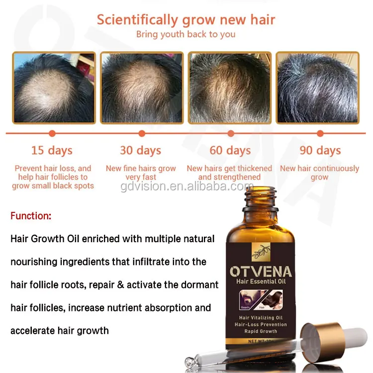 Hair Growth Serum Anti Hair Loss Product Otvena Hair Growth Oil - Buy Hair  Growth Oil,Hair Growth,Anti Hair Loss Product Otvena Hair Growth Oil  Product on 