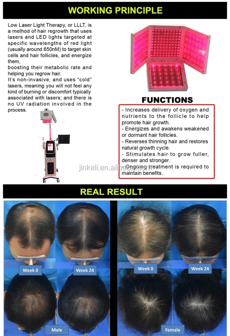 laser hair regrowth.png