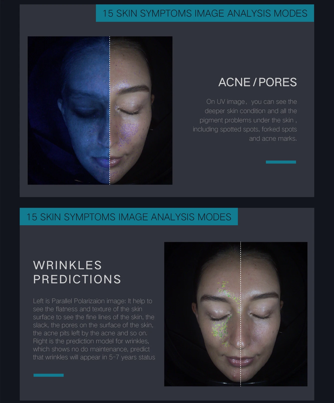 skin analysis system
