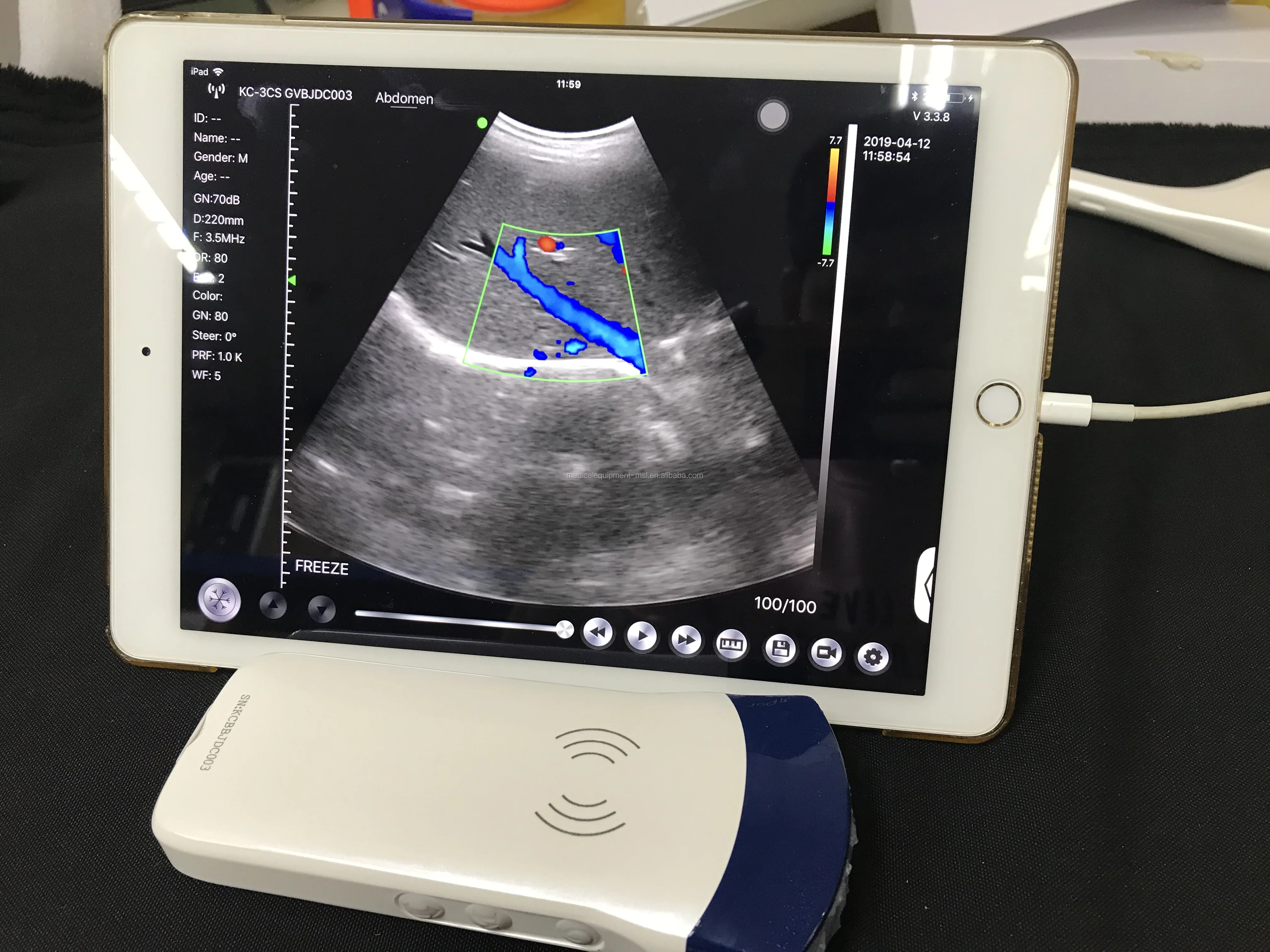 Cheapest Portable Ultrasound Machine Wifi Ultrasound Probe Buy