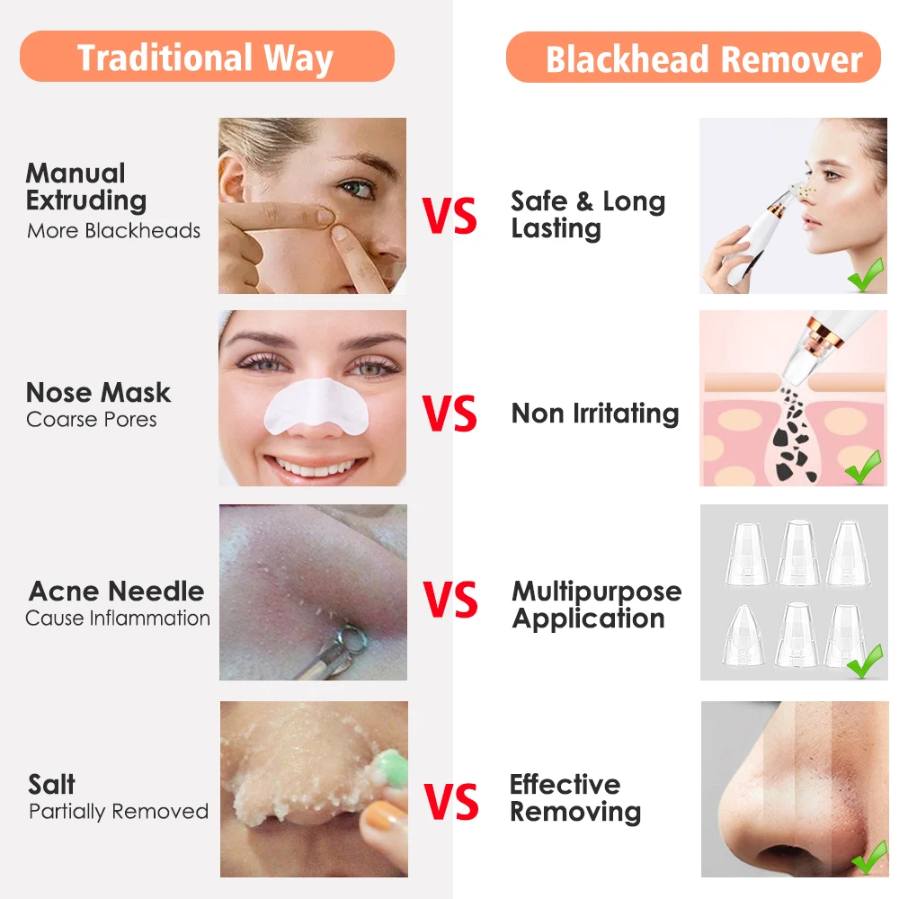 Electronic Professional Skin Face Deep Nose Pore Pore Cleaner Vaccum microdermabrasion Blackhead Suction Remover .jpg