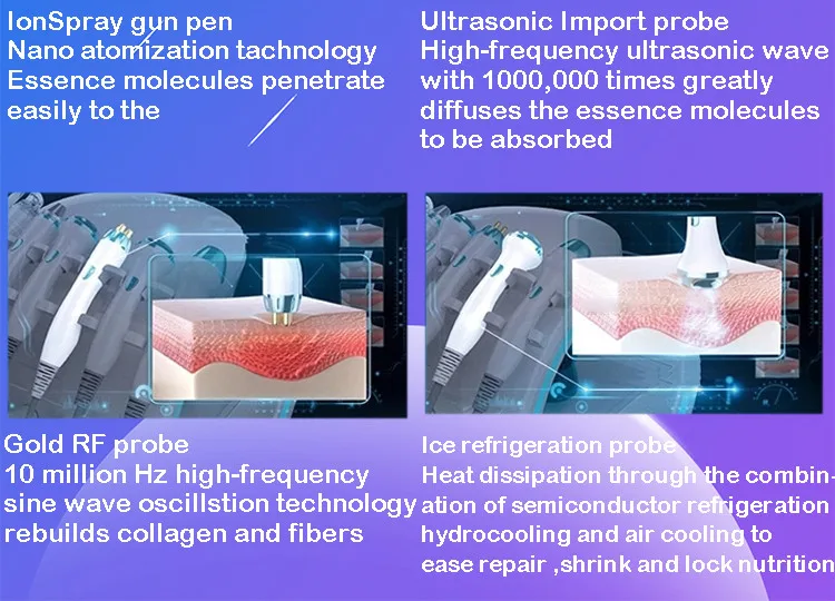 SW-584B_ENP1_Detail(4)