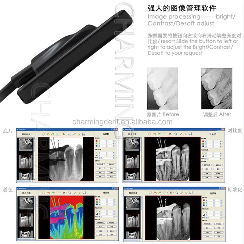 Promotion Price Dental Xray Sensor Rvg Handy Hdr 500 / Wireless Dental Digital Sensors
