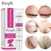 RtopR Acne Scar Stretch Marks Remover Cream Skin Repair Face Cream Acne Spots Acne Treatment Blackhead Whitening Cream Skin Care