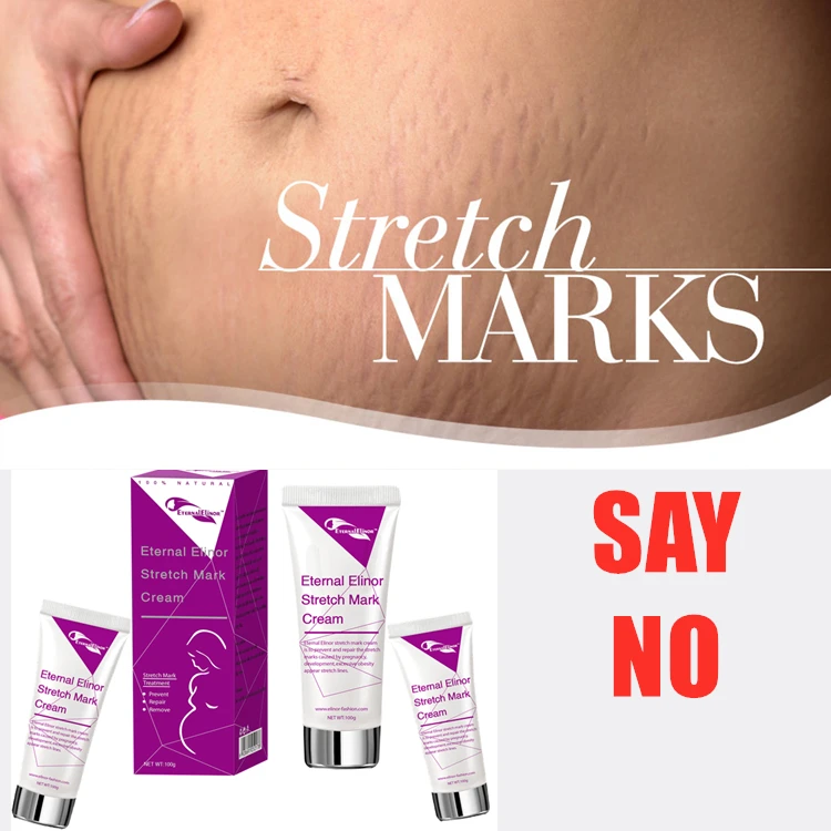 striae gravidarum cream