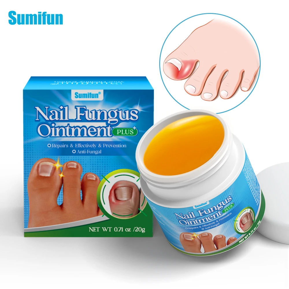 Good Effect Sumifun Anti Fungal Nail Infection Herbal Toe Nail Fungus ...