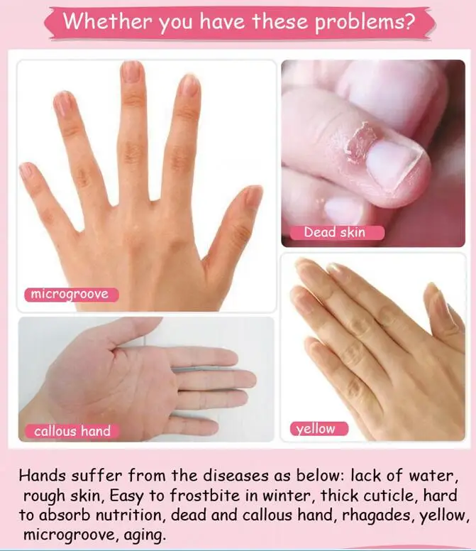 hand mask    28