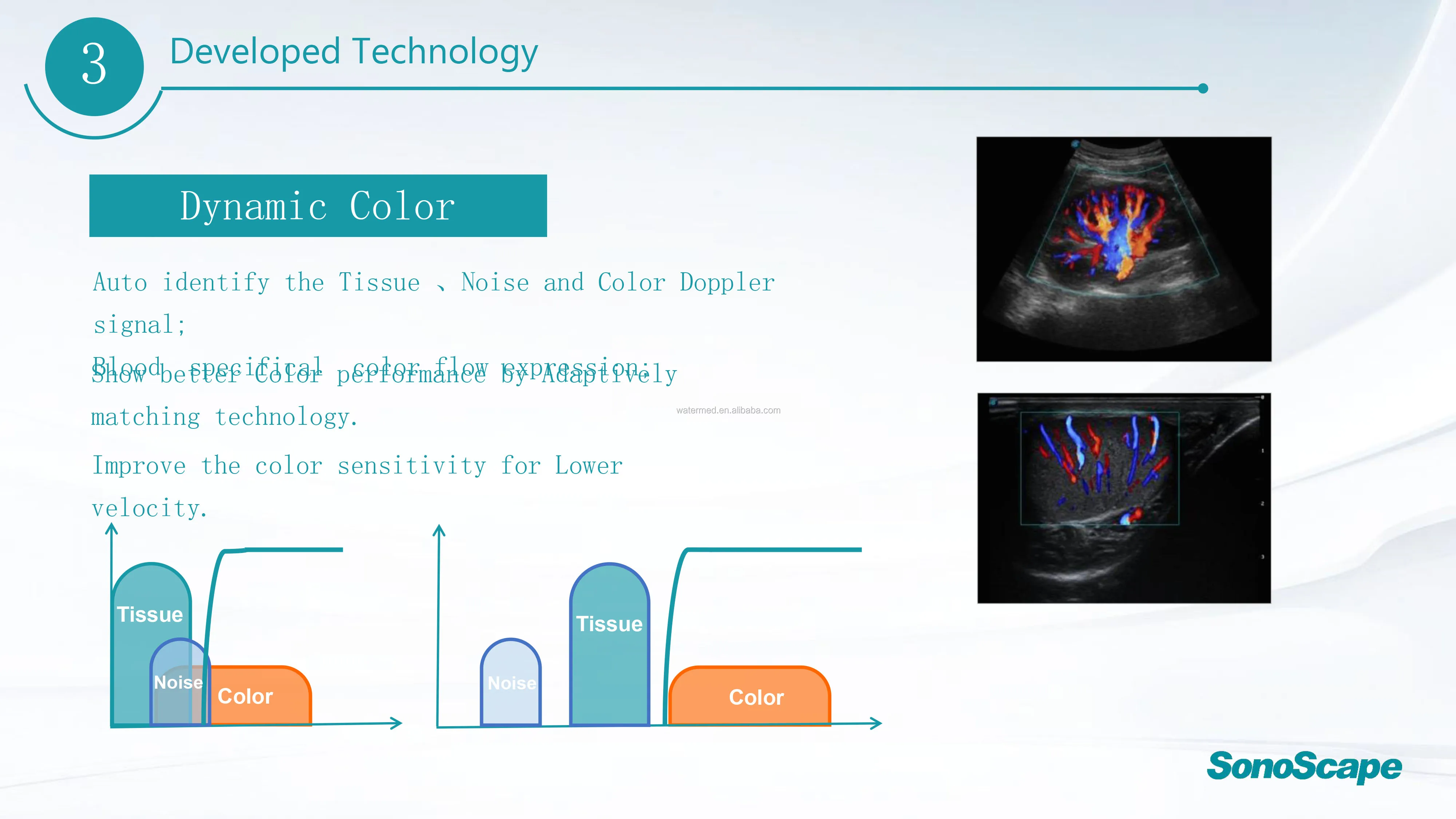 Msk Ultrasound Tdi Cw Color Sonoscape E2 E3 & Sonoscape E1 Usg - Buy ...