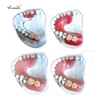 Producing Steps of Articulator Dental Model