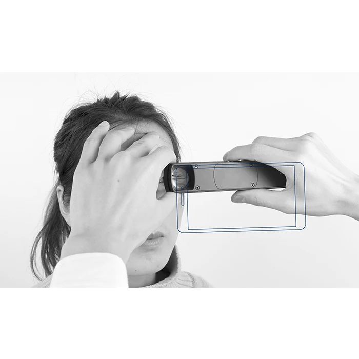 S150D China ophthalmic  6X Portable digital veterinary human slit lamp with APP with mobile adaptor