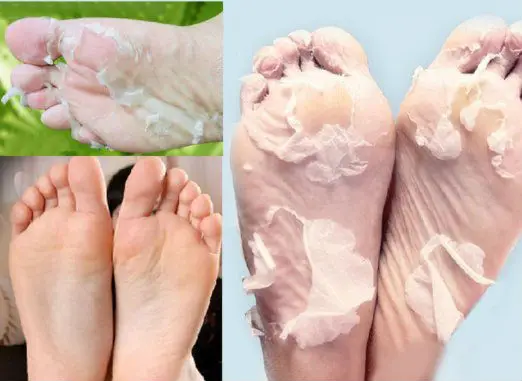 foot exfoliating booties