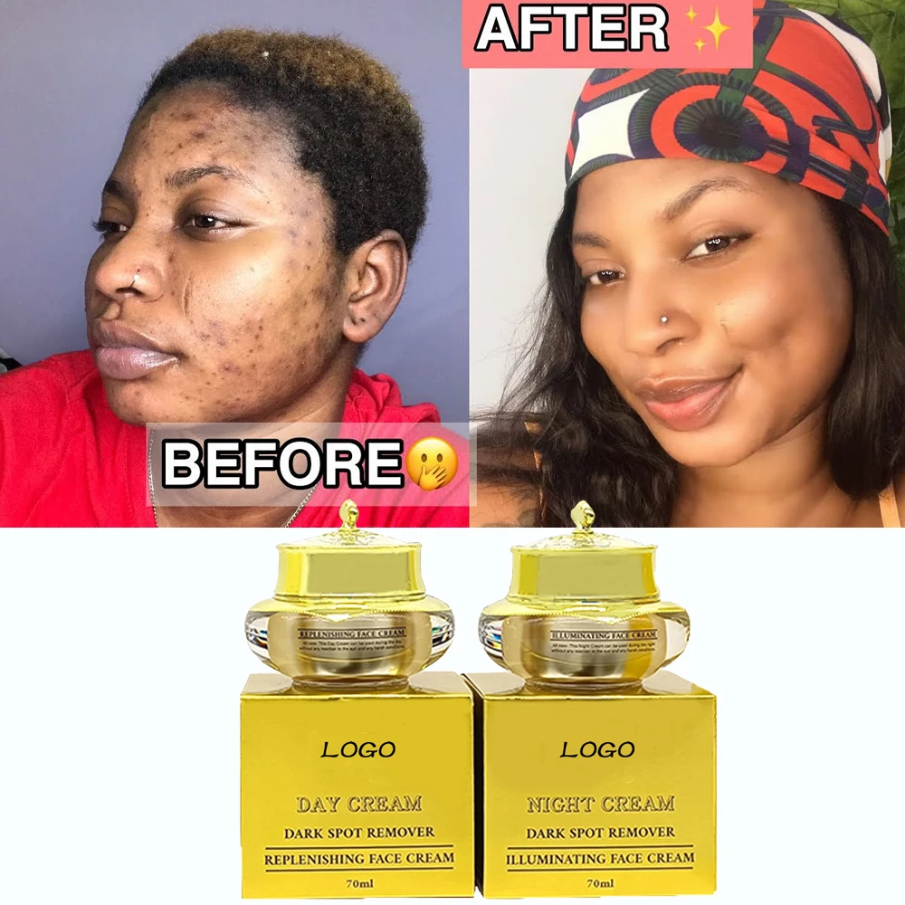 african glutathione whitening night cream Best Lighting Skin Products Remove Black Spots Blemish Day And Skin Brightening Cream Custom Logo Vaseline Glutaglow Ultra Bright COUNT:30 Capsules Glutathiome