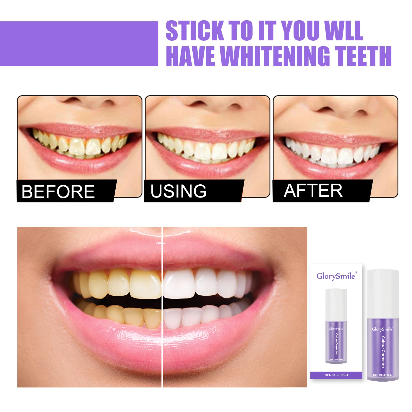 Glorysmile 30ml Brighten Hi Tooth Smile Teeth Whitening V34 Colour ...