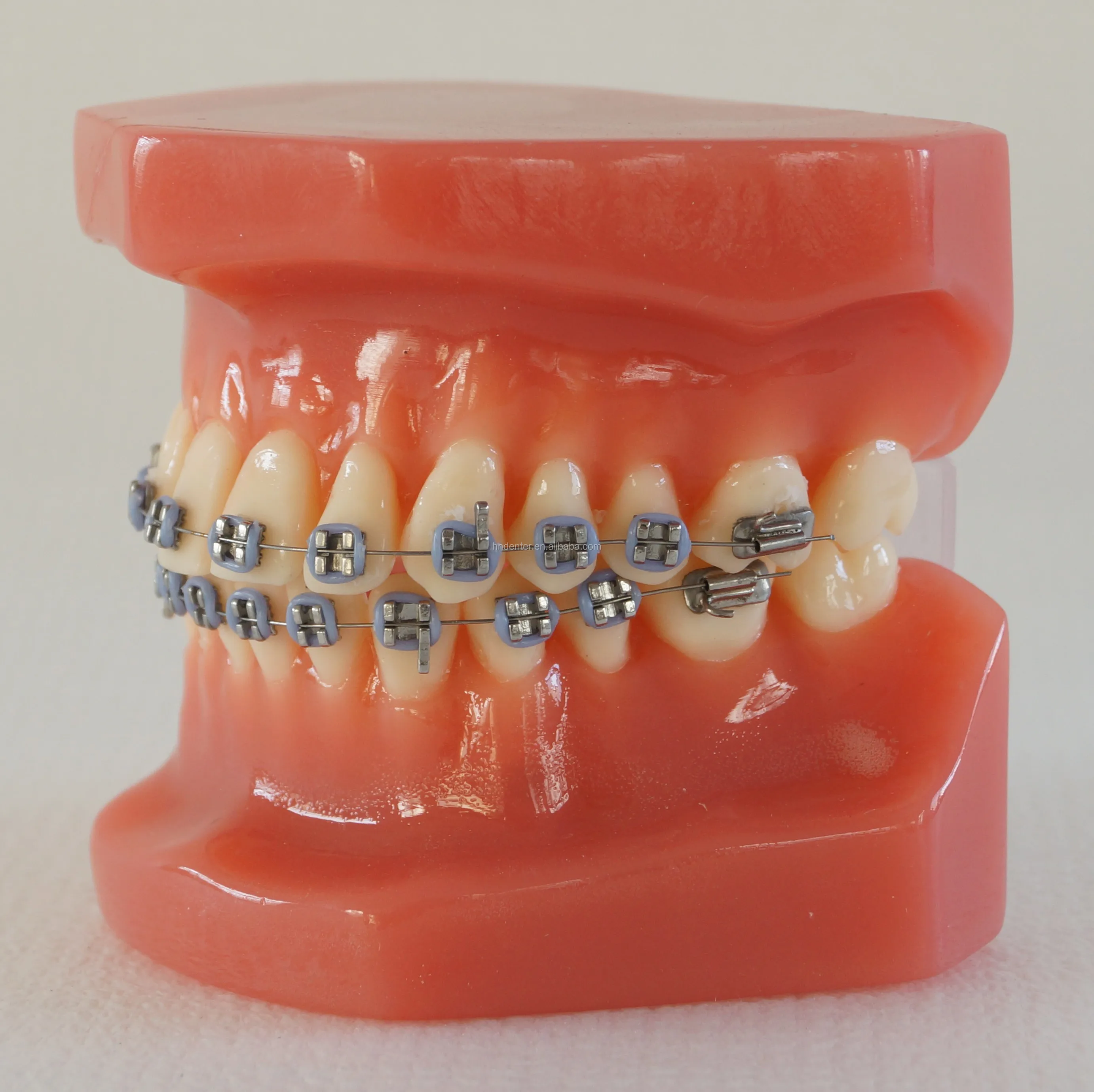 orthodontic.JPG