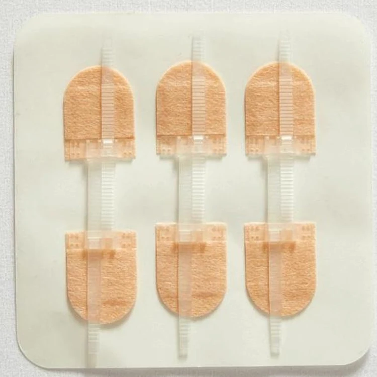 3 Pieces/set Zipper Bandaid Wound Closure Patch Hemostatic Patch Wound Fast Suture Zipper Band