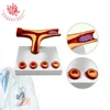 Atheriosclerosis and thrombosis Blood vessel pathology model