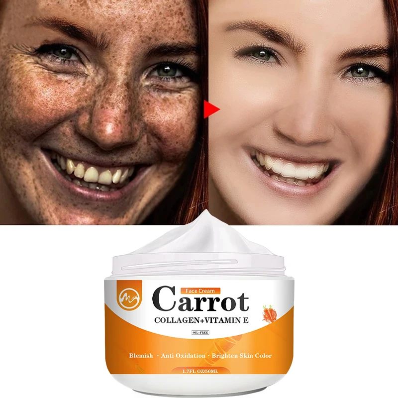 Minch Carrot Face Cream Dark Spot Corrector Brighten Blemish Freckle