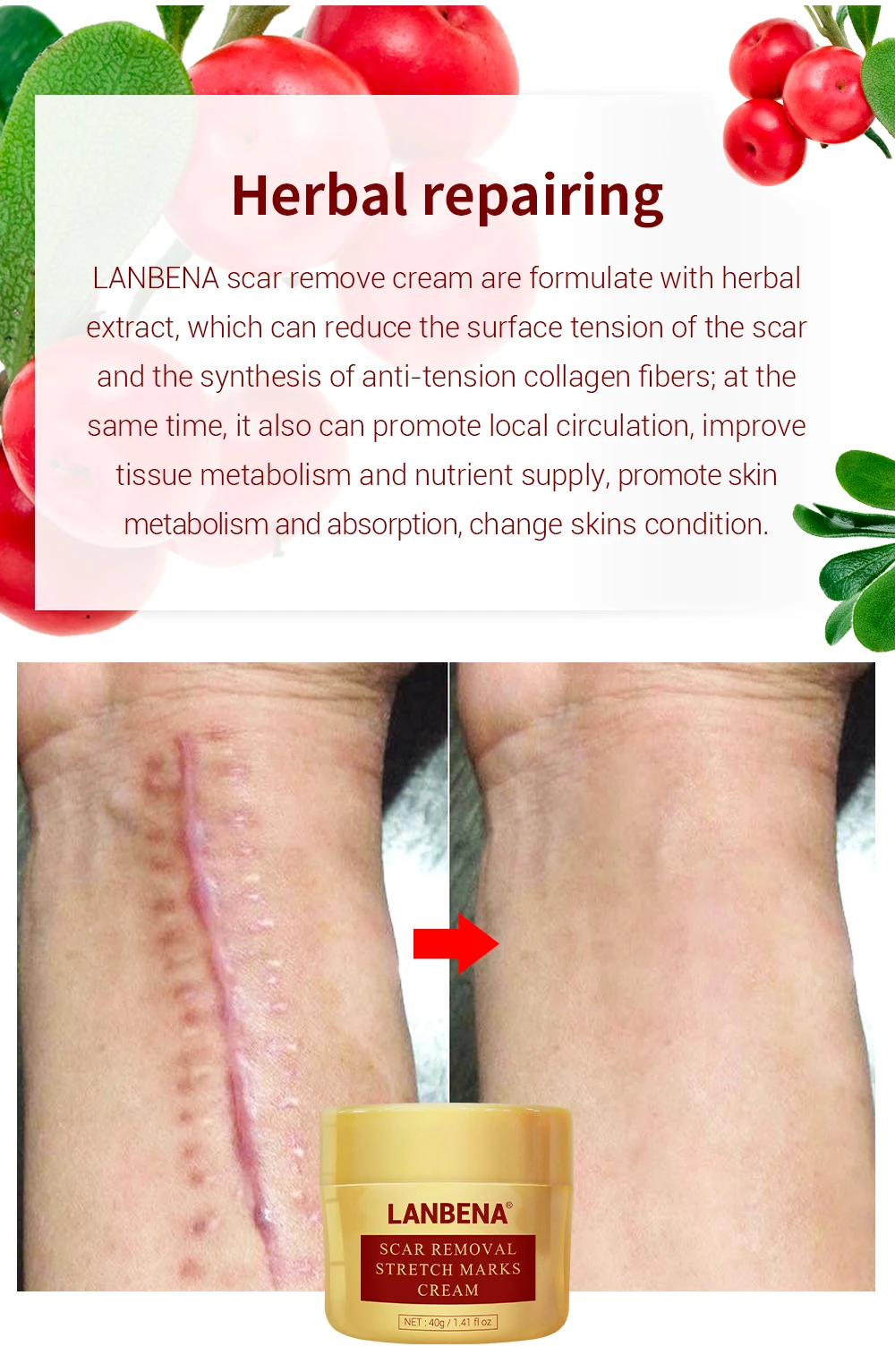 Lanbena Scar Removal Cream Acne Treatment Repairing Scar Non Irritating Whitening Cream Anti Winkles Moisturizing Skin Care 40g Buy Face Cream Gentle Magic Skin Care Professional Skin Care Products Serious Skin Care Product