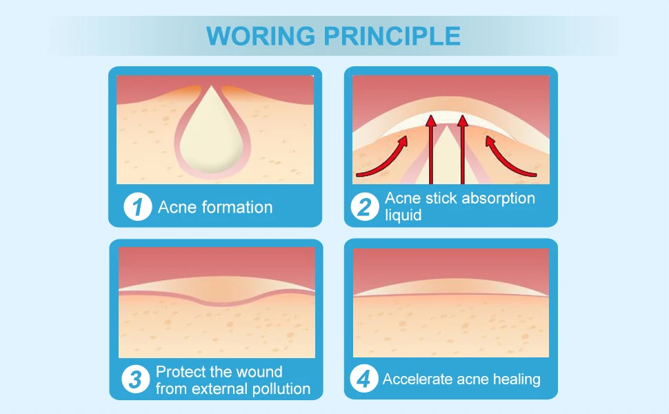 Hydrocolloid acne dressing sticks acne face patch