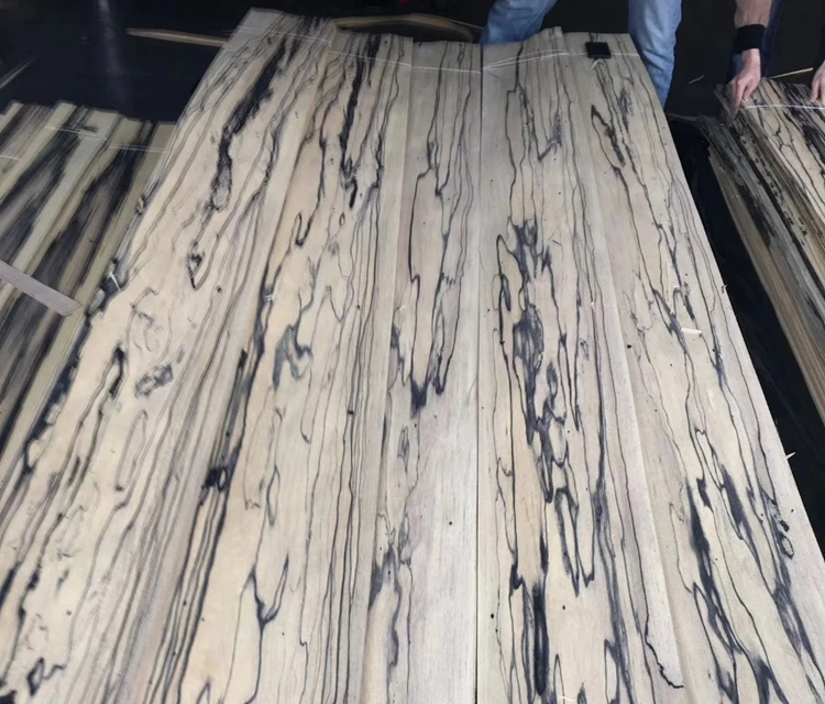 white and black veneers12.jpg