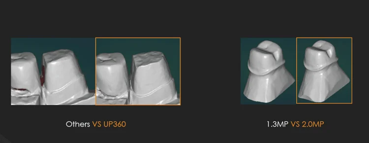 Scanner dentaire 3D, grossissement à 360 degrés, up3d