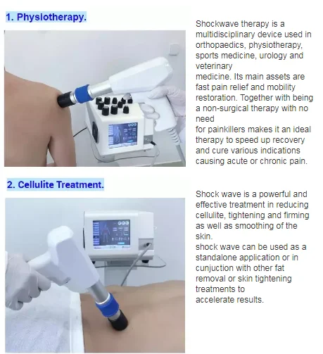 Extracorporeal portable shockwave machine radial focus ED shock wave therapy equipment device for erectile dysfunction