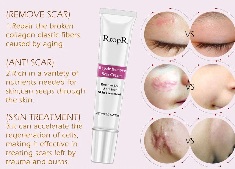 rtopr repair remove scar cream