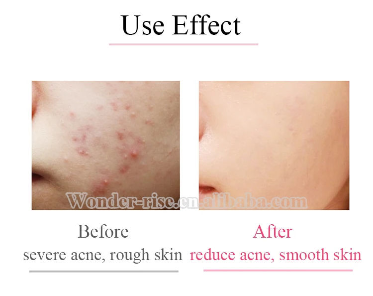 use effect.jpg