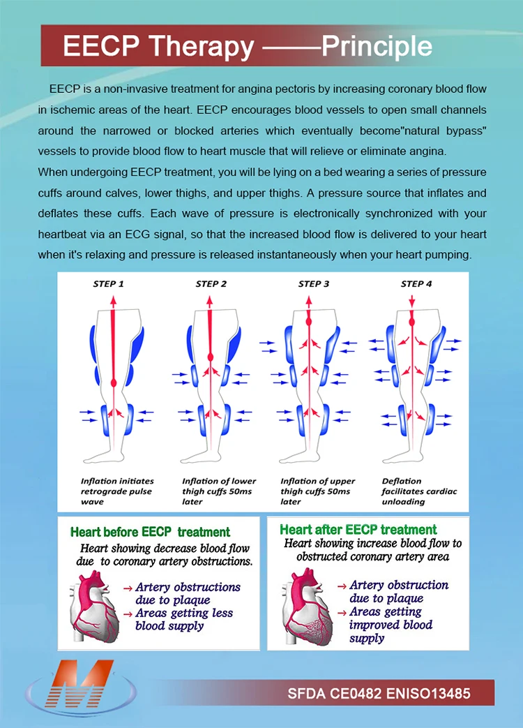 CE ISO approved EECP heart therapy machine