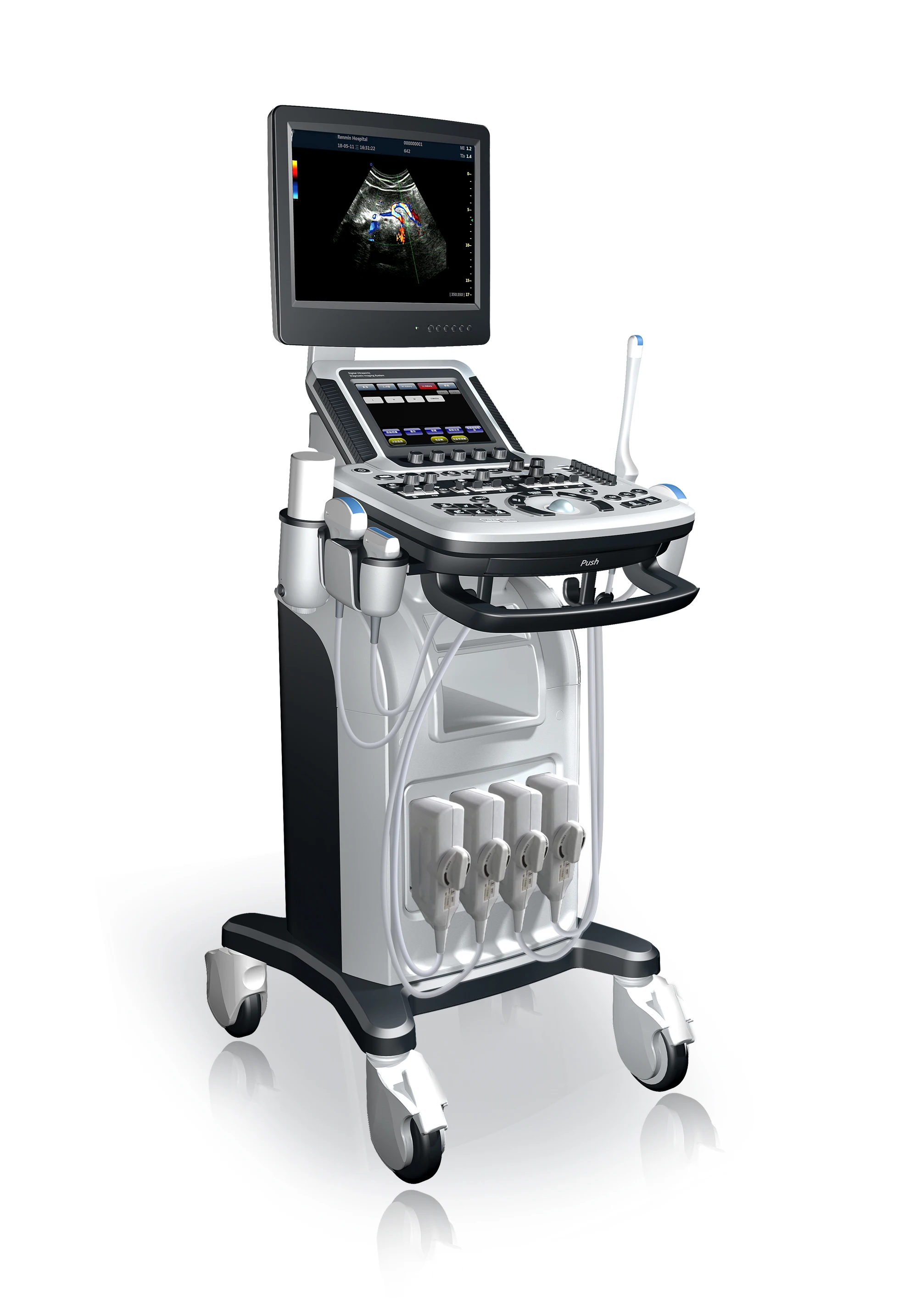 Best Pregnancy Ultrasound Scanner 4d Ultrasound Machine View