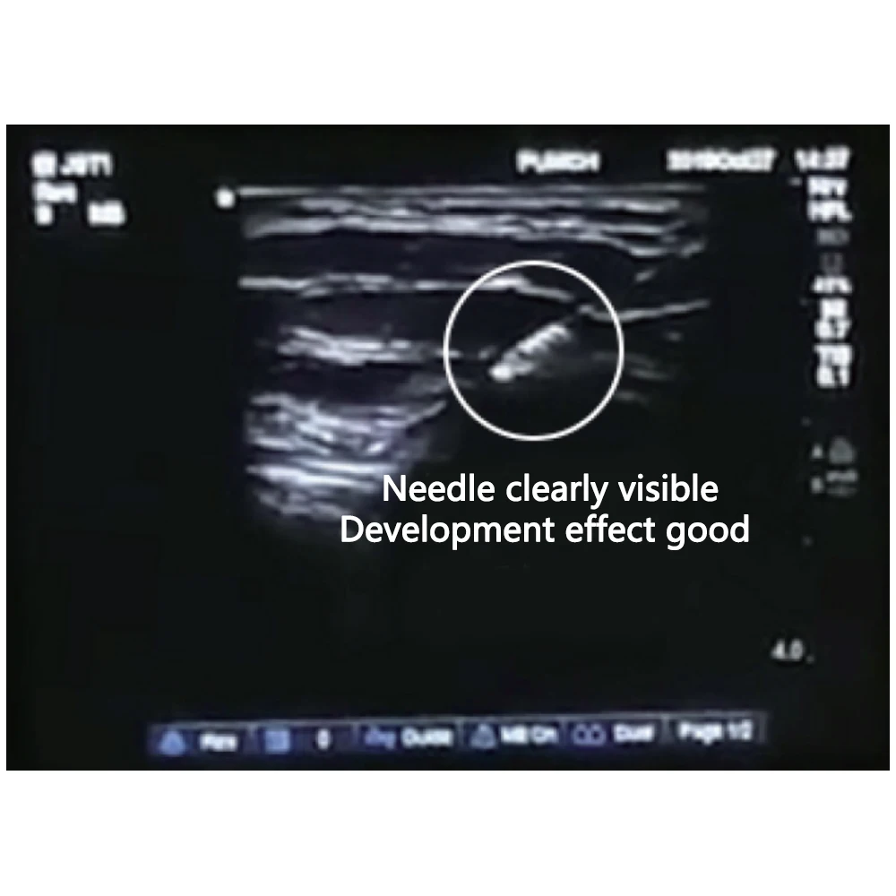 Ultrasound-guided nerve block puncture needle (Pain  Anesthesiology) details