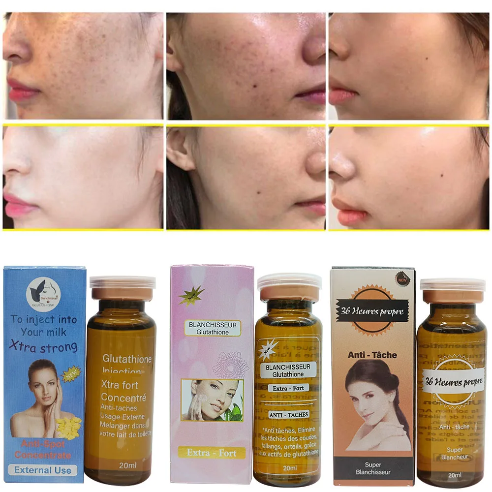The Best Skincare Anti-spot & Super Lightening & Whitening & Glowing with  Vitamin C & Glutathio Facial & Body Serum External Use