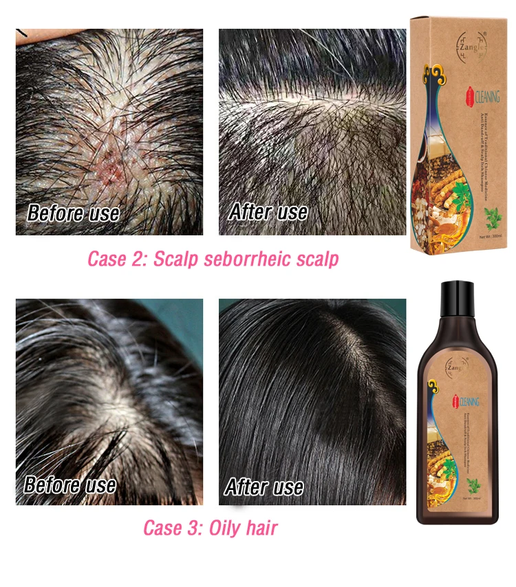 Natural Organic Chinese Herbal Blacking Hair Shampoo For Black Hair