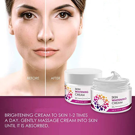 cream for hyperpigmentation face
