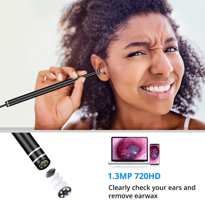 ear wax removal (8).jpg