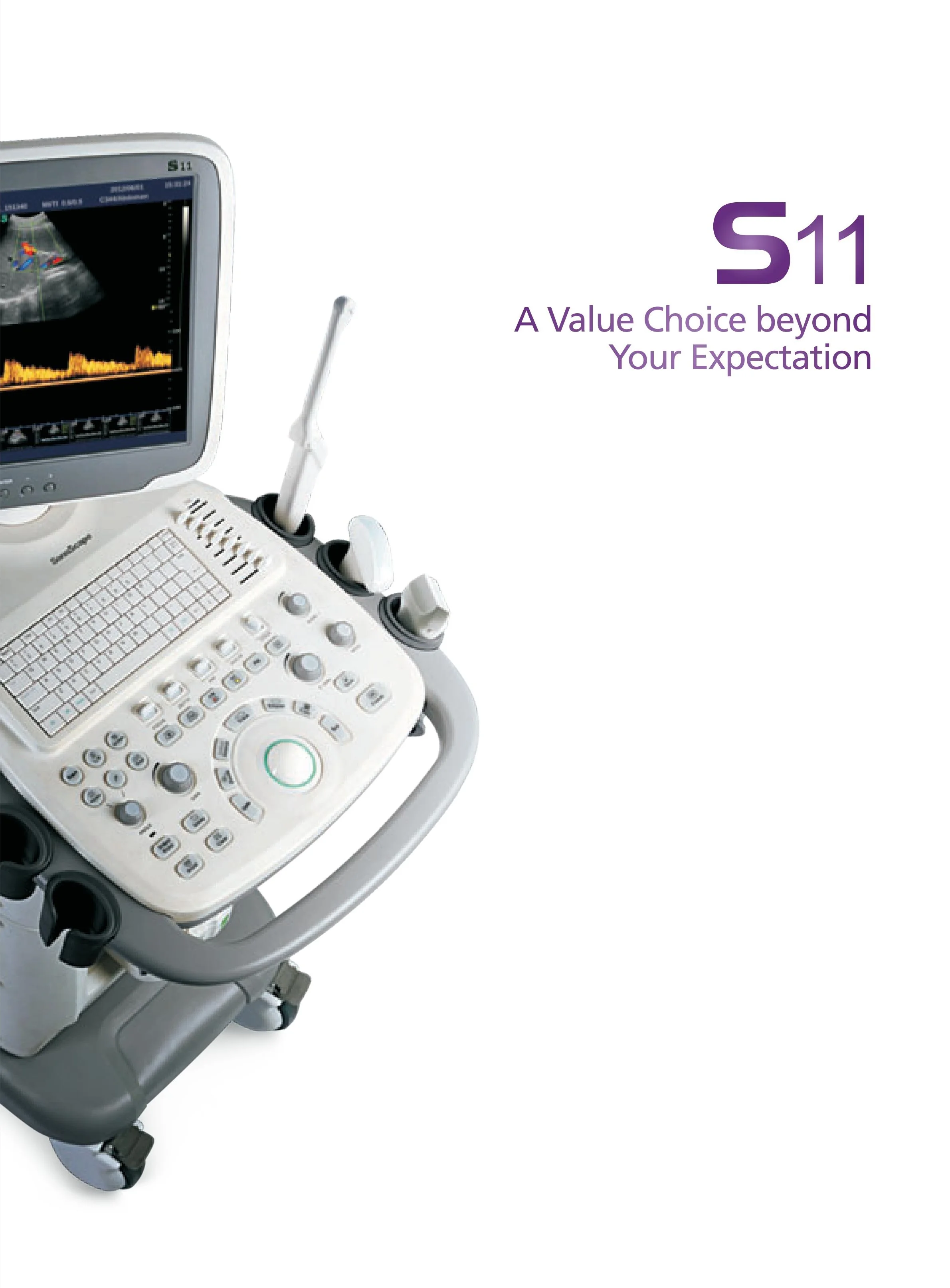 Sonoscape S11 Trolley Color Doppler Ultrasound system USG 15-inch High-Resolution Color LCD