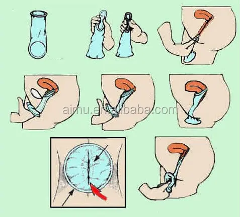 female condom 18.jpg