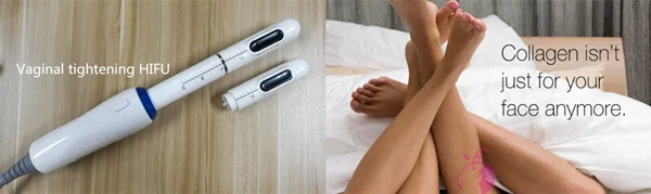 vaginal hifu.png