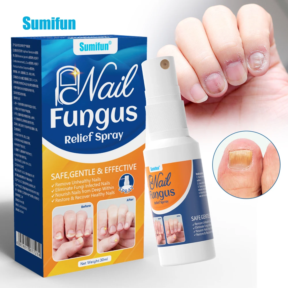 Sumifun Nail Fungal Treatment Finger Care Essence Anti Infection Finger ...