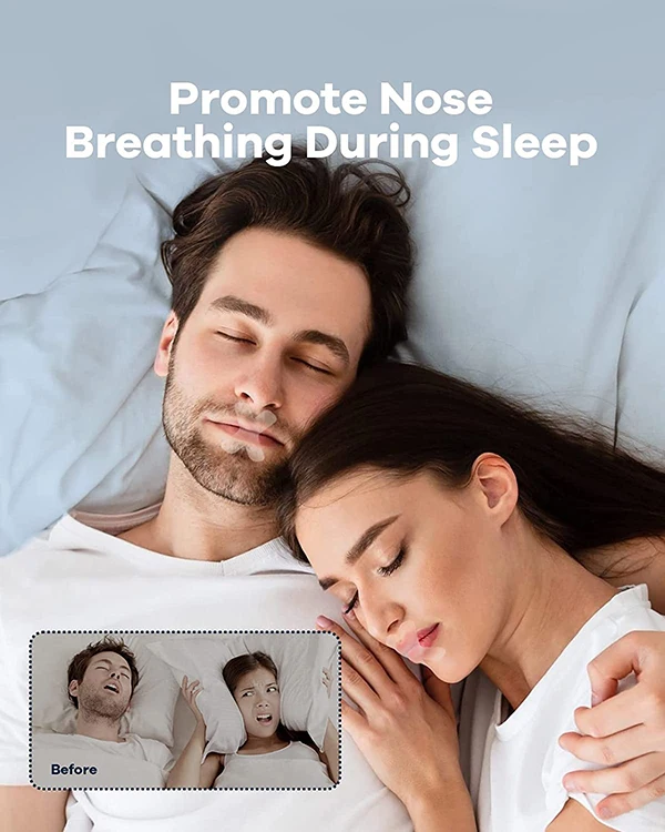 Anti-snoring Mouth Band Better Nose Breathing Sleep Aid Mouth Band ...