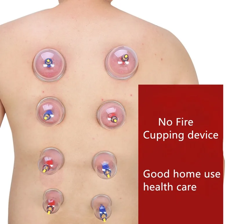 cupping cup.jpg