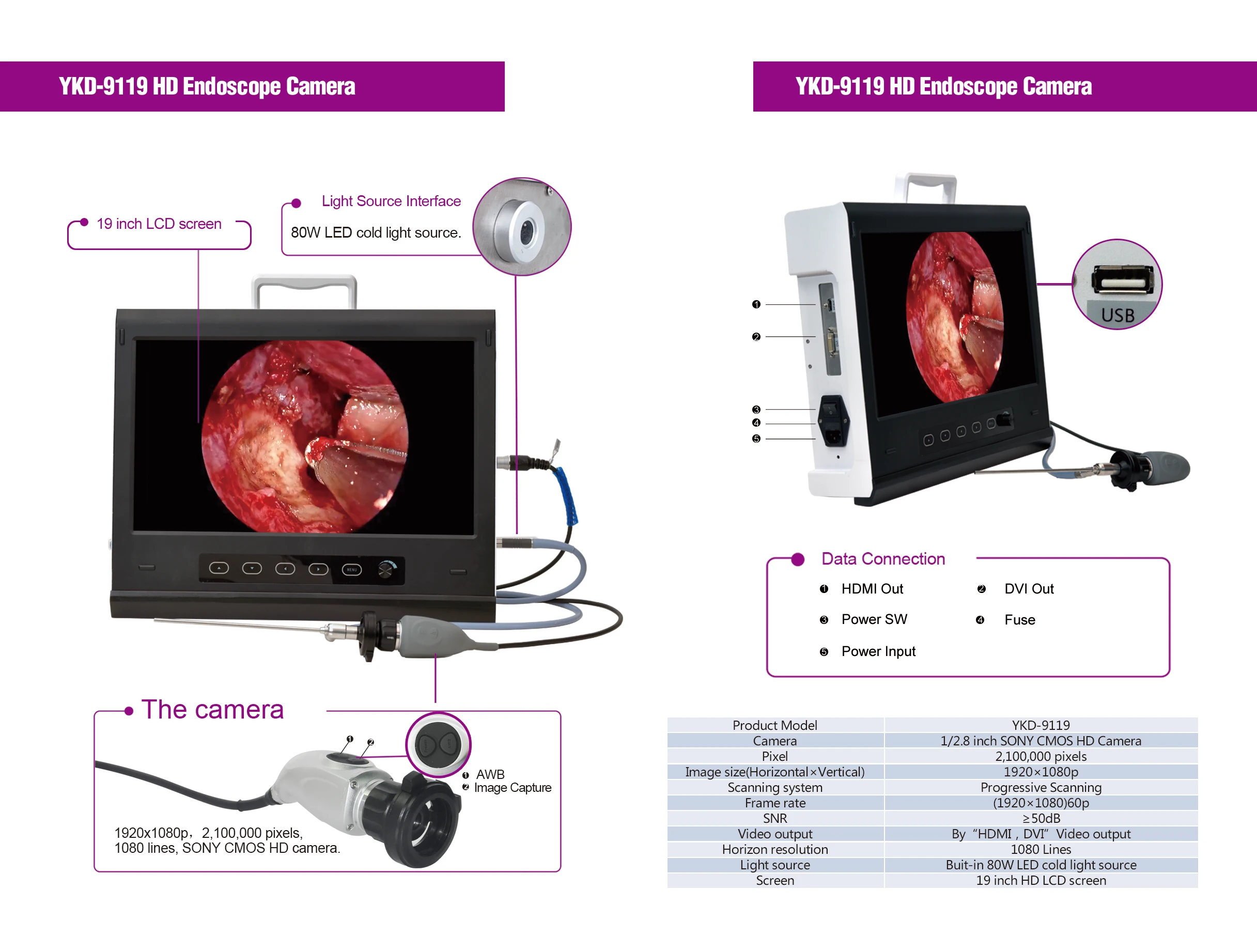 Ykd9119 Portable Laparoscopy And Ent Endoscopy Hd Camera Set(new