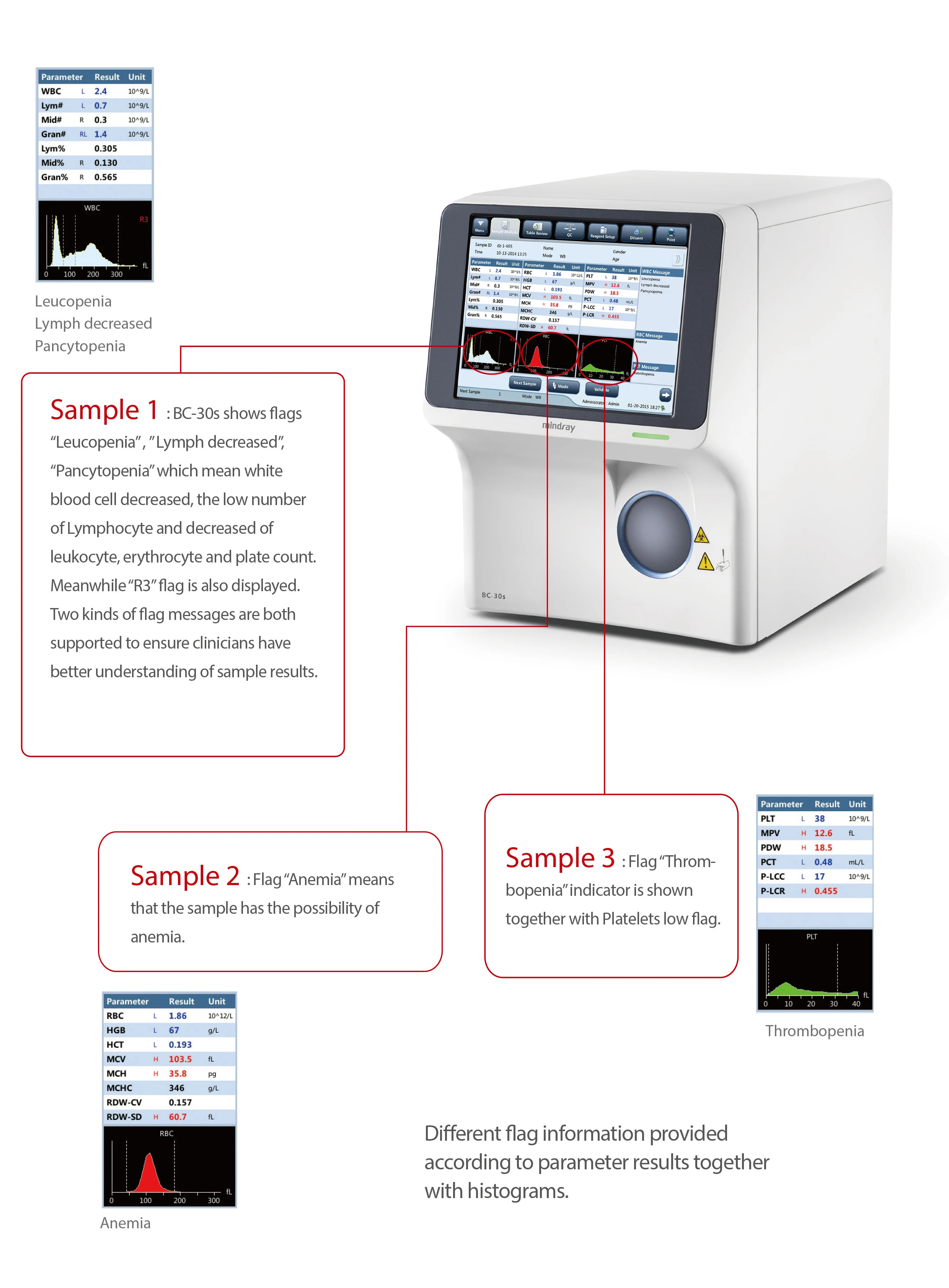 Bc-30s 3-part Diff Auto Mindray Hematology Analyzer Medical Equipment ...